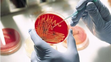 Bakterienkultur für Prostatitis, um Antibiotika zu verschreiben