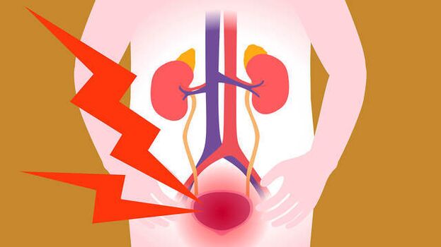 Schmerzen im Blasenbereich bei akuter Prostatitis